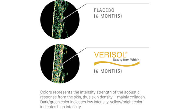 Density of dermis image by S-C-Nutrition.